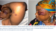 « Frappés sans raison » : une famille Congolaise accuse la police flamande de violences racistes